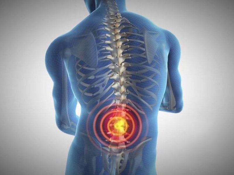 Spinal Tumors